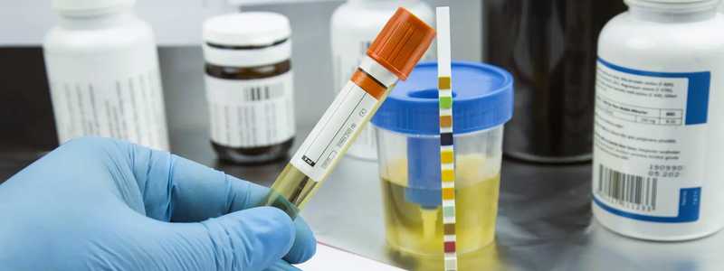 Conducerea sub influența drogurilor: Oare simpla existență a substanței psihoactive în organism conduce la condamnare?